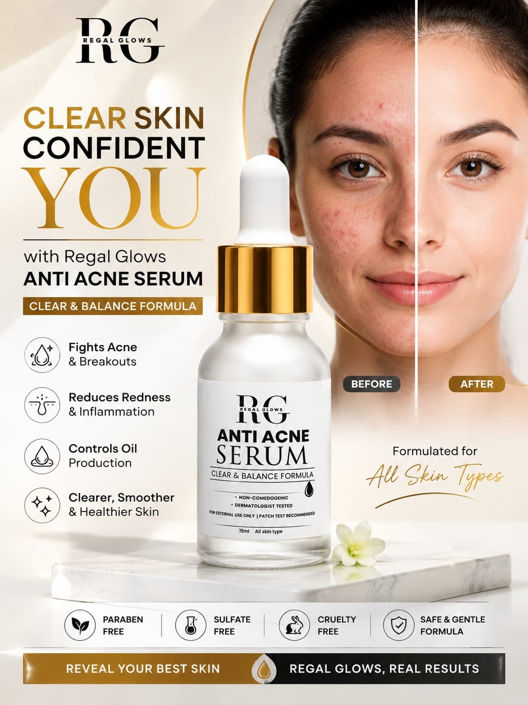 Anti Acne Serum — Clear & Balance Formula - Image 2