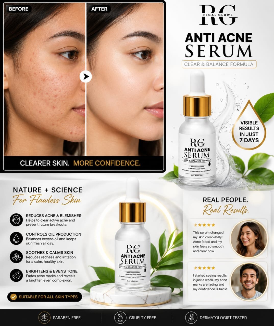 Anti Acne Serum — Clear & Balance Formula - Image 3